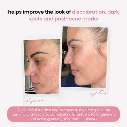 Kojic Acid & Turmeric Cleansing Pads (40 Pieces) – Brightens & Energizes Skin