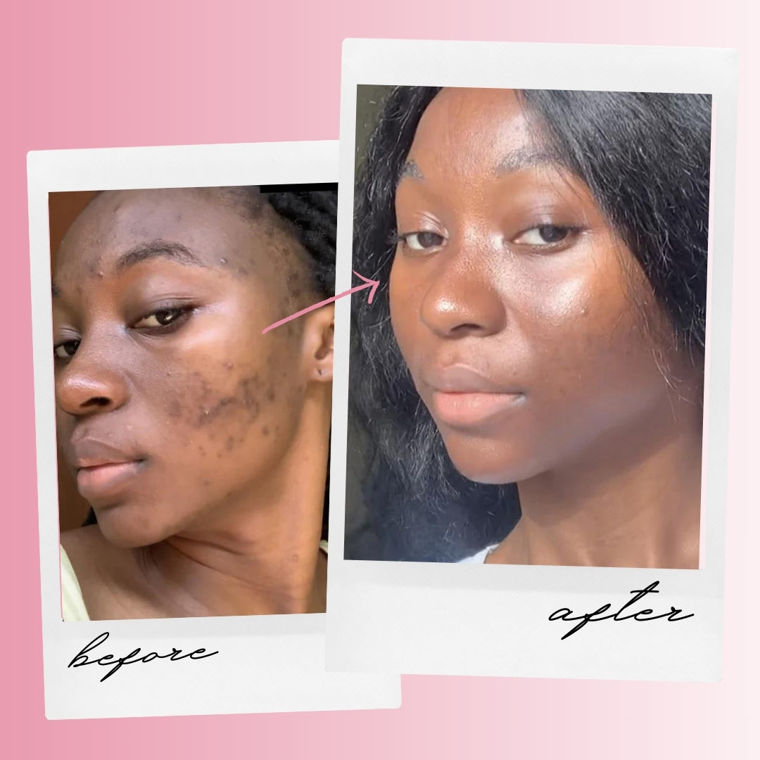 Kojic Acid & Turmeric Cleansing Pads (40 Pieces) – Brightens & Energizes Skin