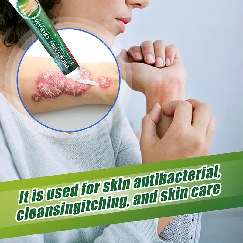 Psoriasis Cream (Original)